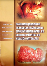 Canlidan Qaraciyər Transplantasiyasinda Əməliyyatdan Əvvəl Və Sonraki Müayinə Və Müalicə Qaydaları